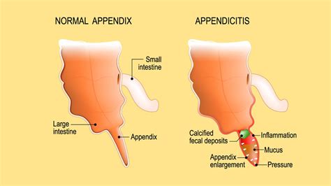 Appendix