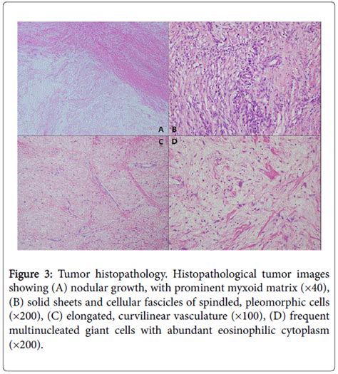 cytology-histology-tumor-histopathology