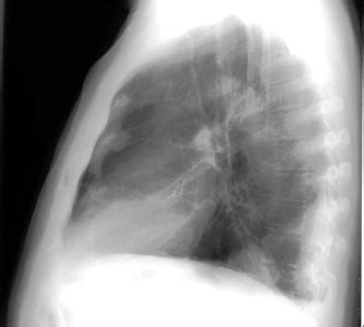 Chest Radiology