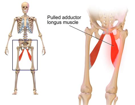 Diagram Of Groin Area Groin Area Anatomy Anatomy Drawing Diagram | Images and Photos finder