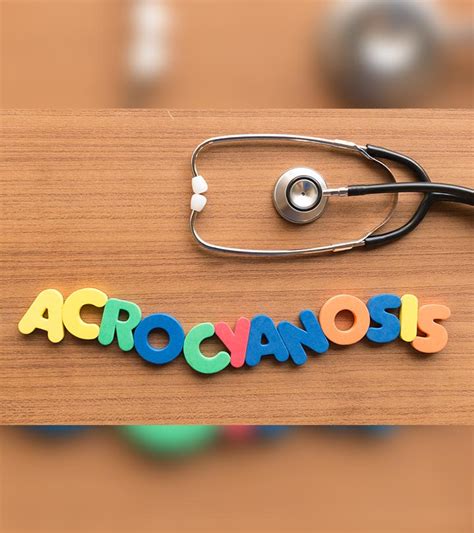 Acrocyanosis In Newborn: Causes, Symptoms, Diagnosis And Treatment - Baby Plumbing