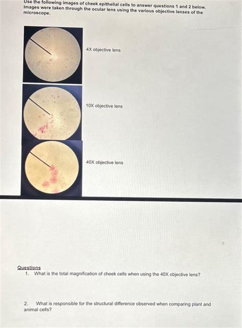 Solved Use the following images of cheek epithelial cells to | Chegg.com