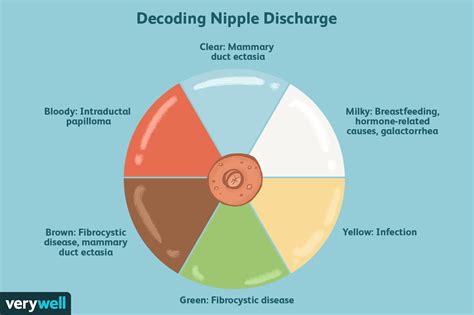 Nippel-Entladung: Symptome, Ursachen, Diagnose und Behandlung