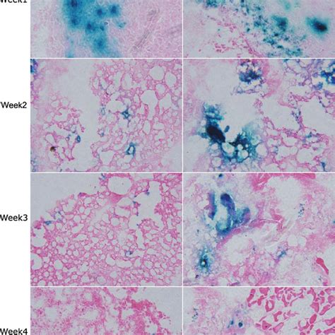 Characterization of the formulated Ad5-LacZ in vivo including LacZ gene... | Download Scientific ...