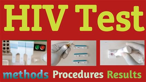 HIV Test kit Procedure in Hindi 3 Methods and Results - YouTube