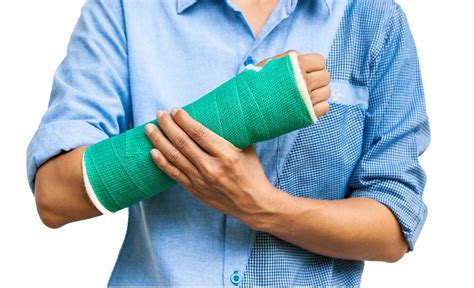 Soft Cast Removal - Fracture Info