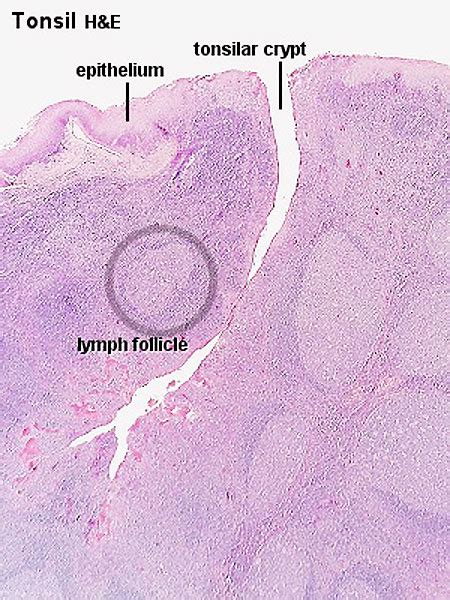 Histology Of Tonsil