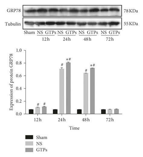 Effects of GTPs treatment on the protein levels of caspase-12 and GRP78 ...