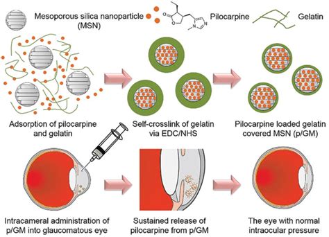 Schematic illustration showing synthesis of silica nanoparticles... | Download Scientific Diagram