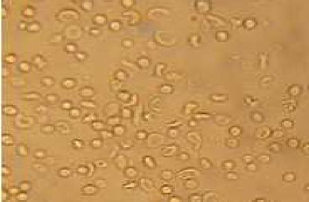 Morphology of drepanocytes treated with Ac 2 fraction (X500). | Download Scientific Diagram