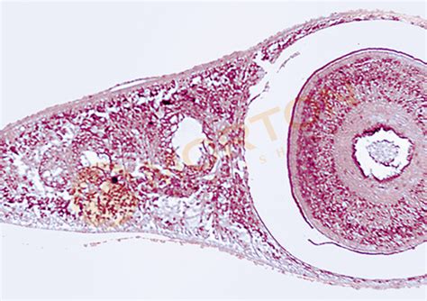 Turbellaria (transverse Section) Diagram | Quizlet