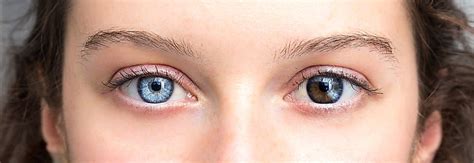 Why Do People Have Different Eye Colors? - WorldAtlas