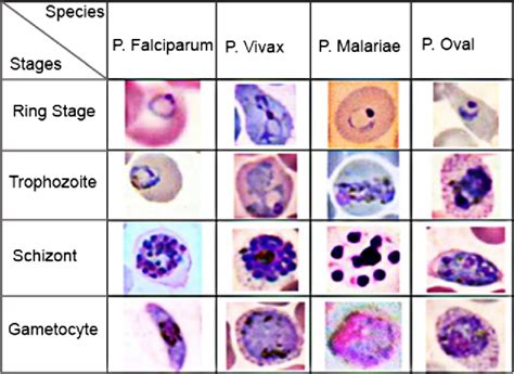 [PDF] A review on automated diagnosis of malaria parasite in microscopic blood smears images ...