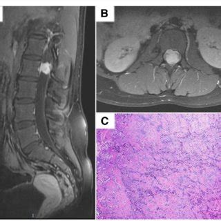 Representative post-contrast T1-weighted MRI images in axial (a) and... | Download Scientific ...