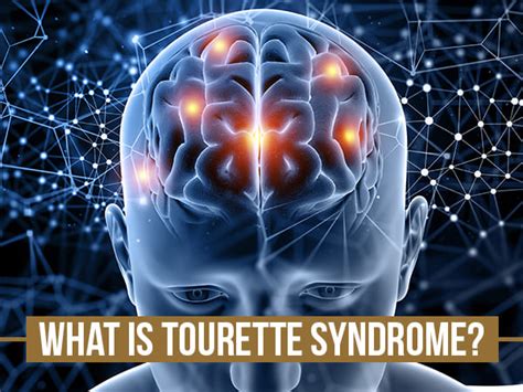 World Disability Day 2022: Tourette Syndrome Causes, Symptoms, Diagnosis And Treatment - Boldsky.com