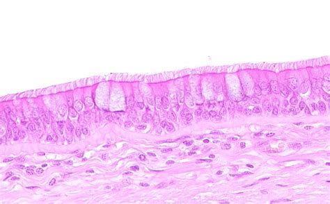 Trachea Histology Goblet Cells