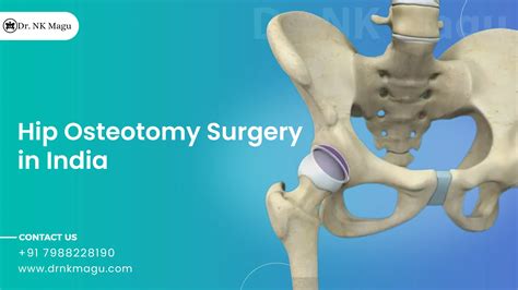 Hip Osteotomy Surgery Cost in India | Dr. Narender Kumar Magu