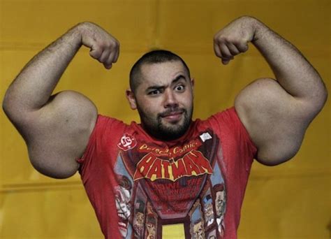 5 Things You Need To Know Before Using Synthol – Sick Chirpse