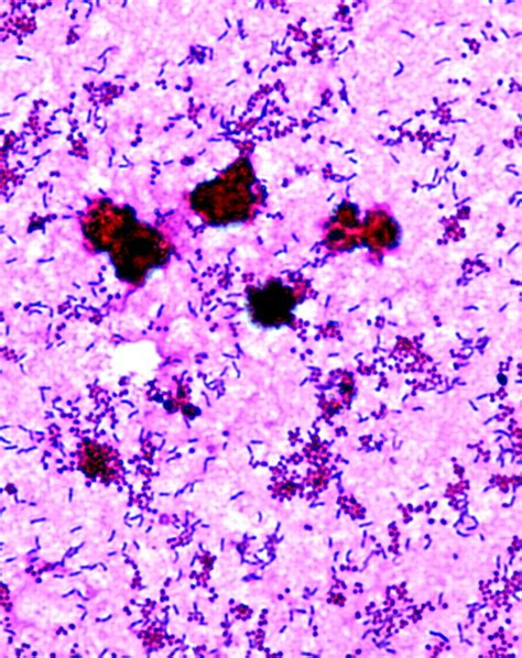 A Gram stain of uncentrifuged urine shows gram-positive rods and... | Download Scientific Diagram