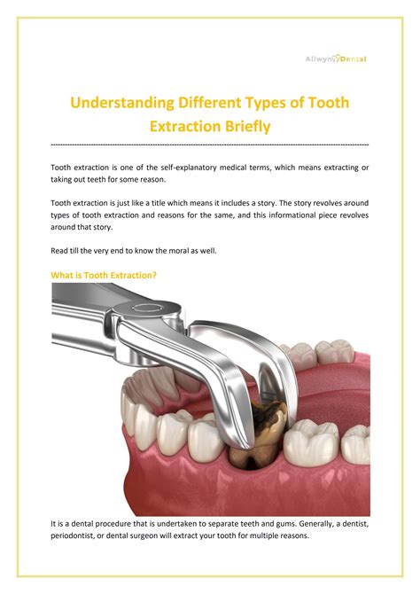 Understanding Different Types of Tooth Extraction Briefly by Allwyn Dental - Issuu