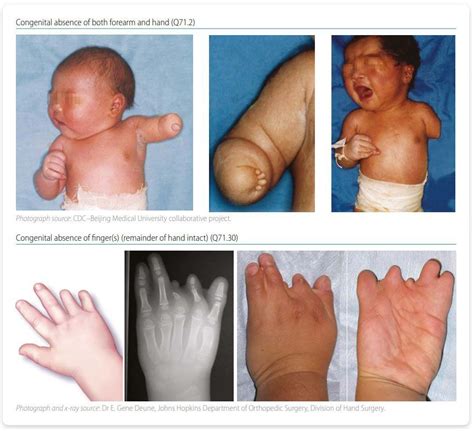 Congenital malformations - MEDizzy