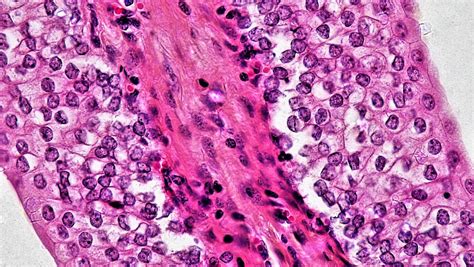 Epithelial Tissues: Transitional | cross section: urinary bl… | Flickr