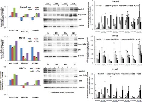 Expression of autophagy markers. The graphs on left show the analysis ...