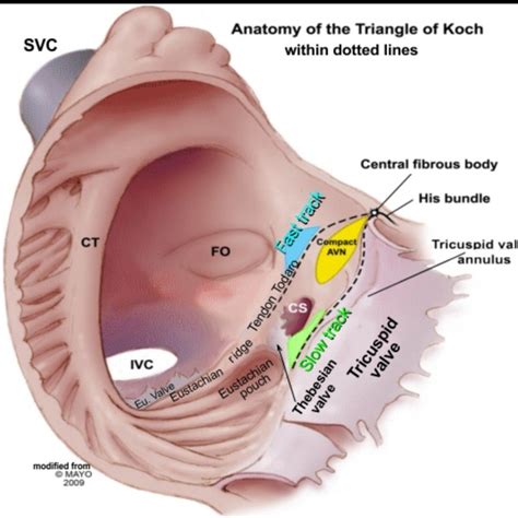 Pin by Kimberly Volkman on lovecho | Diagnostic medical sonography ...