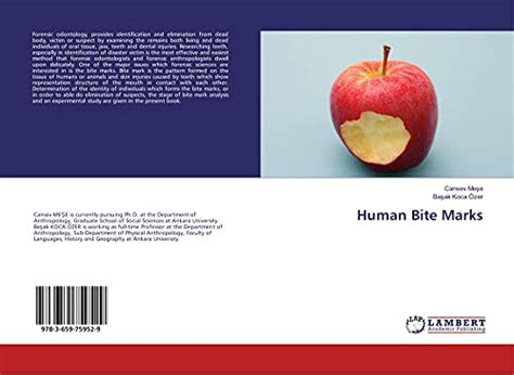 Human Bite Marks - Meşe, Cansev; Koca Özer, Başak: 9783659759529 - AbeBooks