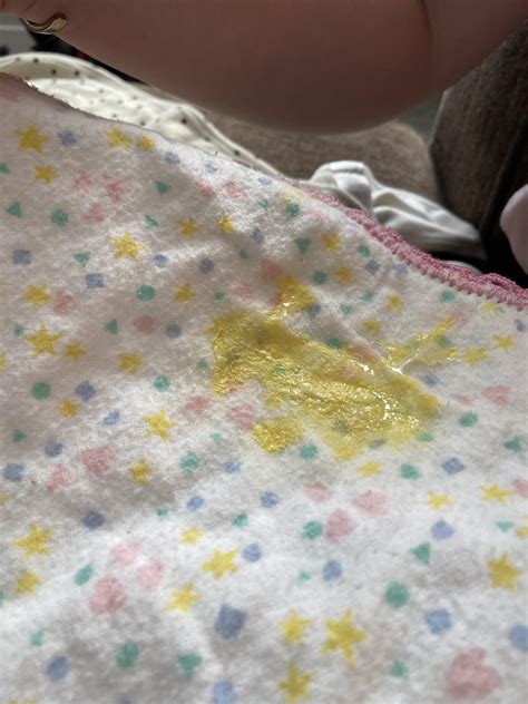 Newborn bright yellow thick spit up. Doc says he’s not worried but ...