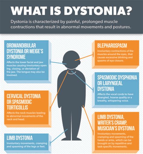 How Does it Feel to Suffer from Dystonia Chronic Pain?