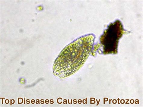 Top 12 Diseases Caused By Protozoa | Malaria, Trypanosomiasis & More