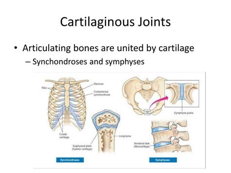 PPT - Joints PowerPoint Presentation - ID:2325082