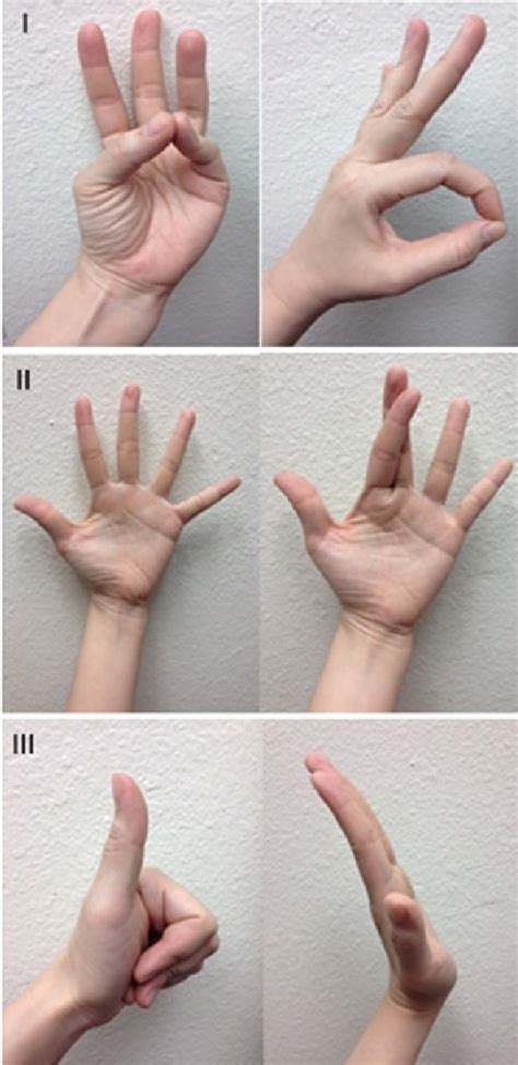 Motor examination of the hand. I: Median nerve. II: Ulnar nerve. III:... | Download Scientific ...