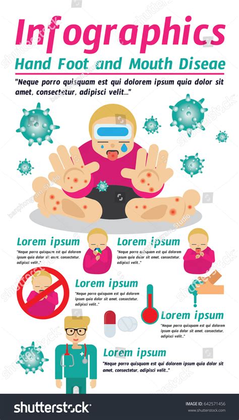 Stock vektor „Hand Foot Mouth Disease Infographic“ (bez autorských poplatků) 642571456 ...