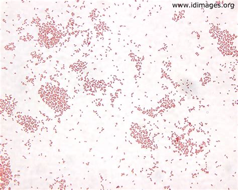 Bordetella pertussis - Stepwards