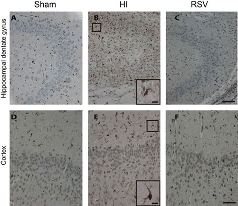 Iba-1 immunohistochemistry. Representative examples of photomicrographs ...