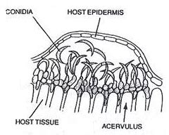 Conidia of ascomycetes| Fruit bodies of Ascomycota| Pycnidia| Sporodochia