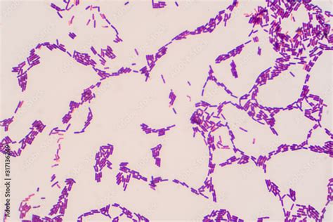 Bacillus Shape