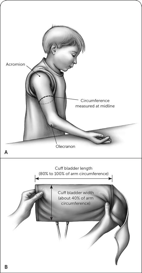 High Blood Pressure in Children and Adolescents | AAFP