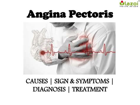 PPT - Angina pectoris : causes, symptoms, diagnosis and treatment PowerPoint Presentation - ID ...