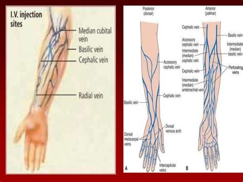 Iv injection- intravenous injection | PPT