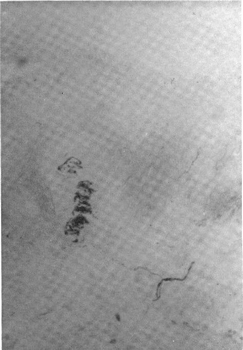 Figure 1 from Vital staining of nerve fibres and endings. | Semantic ...