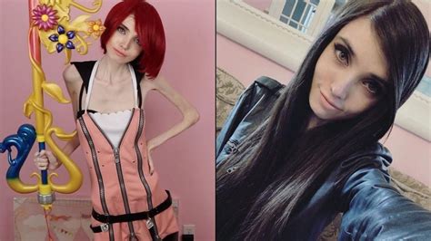 The Harsh Reality Of Eating Disorders: Eugenia Cooney's Before And After