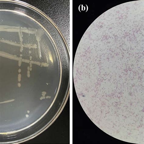 Genome map of Pseudomonas stutzeri BBW831 | Download Scientific Diagram