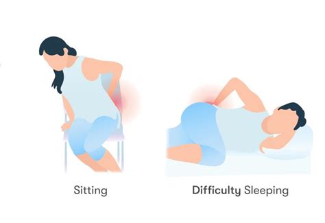 Greater Trochanteric Pain Syndrome (GTPS) - Range Physiotherapy