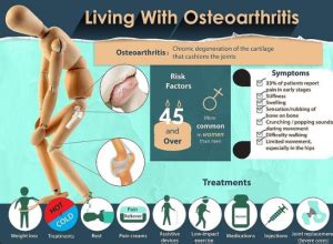 Natural Treatment For Osteoarthritis - Health And Well-Being For Life : Health And Well-Being ...