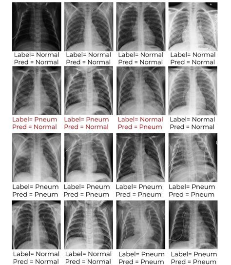 Classification results of some chest X-ray images from the test ...