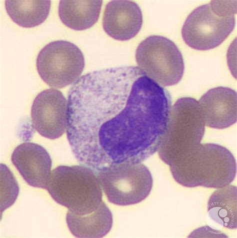 Metamyelocyte