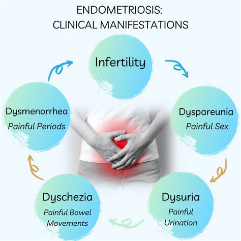 Understanding Endometriosis: Unveiling the Common Symptoms and Their ...